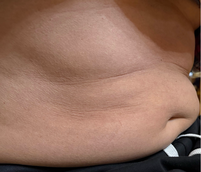 chto_takoe_metabolicheskoe_zdorove_-_i_pochemu_segodnya_o_nyom_govoryat_vse.png